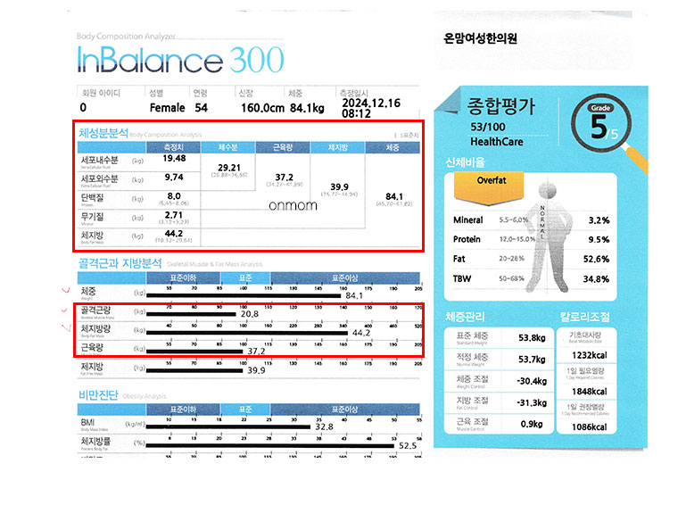 다이어트 알약(슬림정) 4개월 (-18.6kg), 160cm 84.1kg→65.5kg