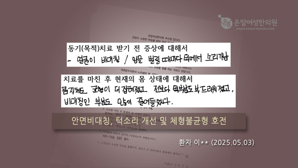 안면비대칭-이응경.jpg